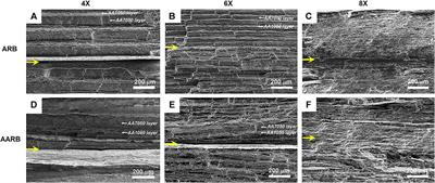 The Effect of Asymmetry on Strain Distribution, Microstructure and Texture of Multilayer Aluminum Composites Formed by Roll-Bonding